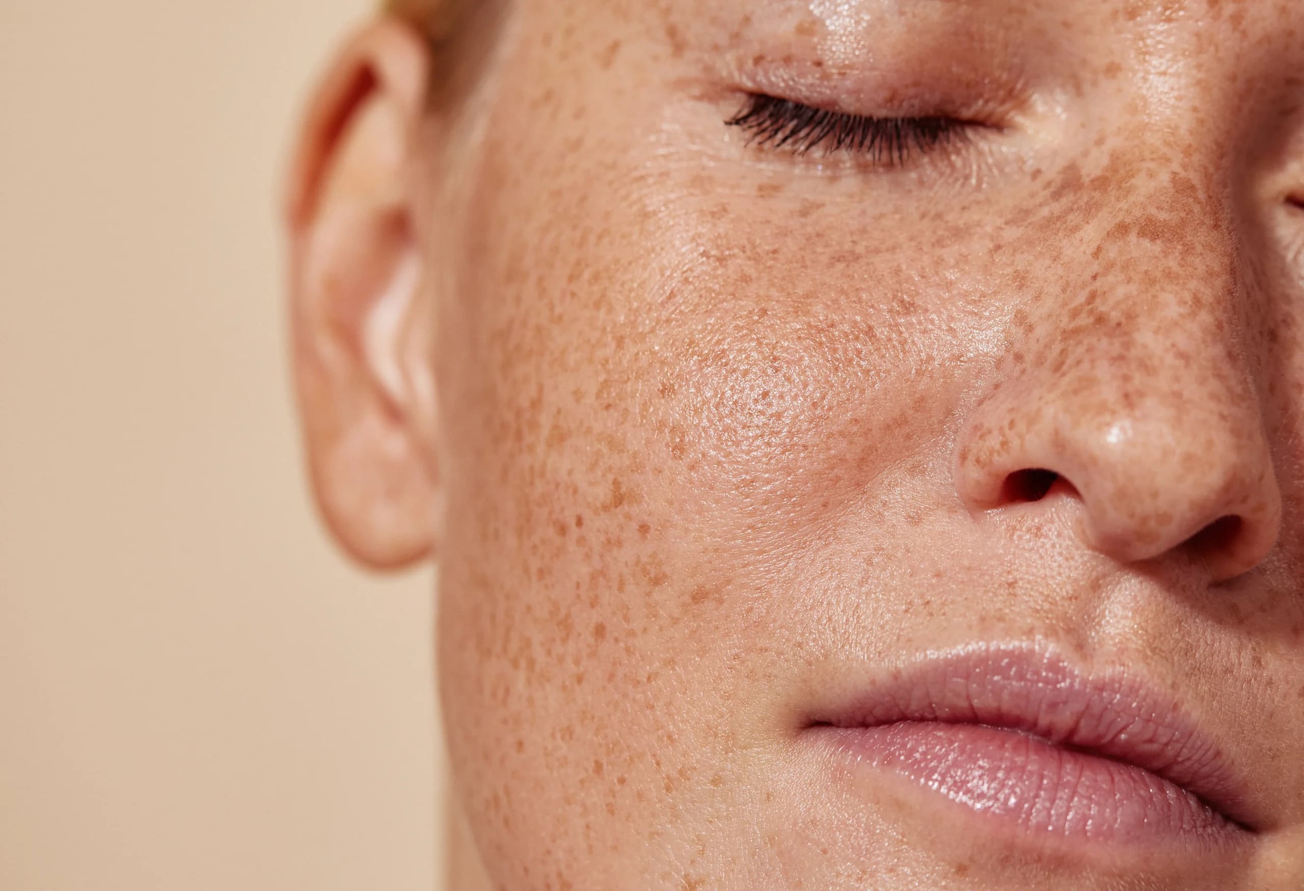 Understanding Pigmentation: What You Really Need to Know